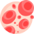 Anemia Anemia